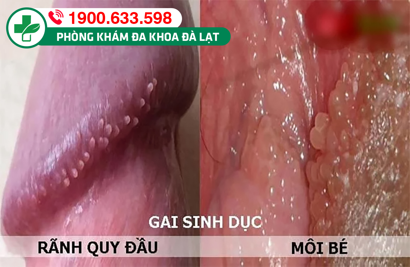 Hình ảnh minh họa